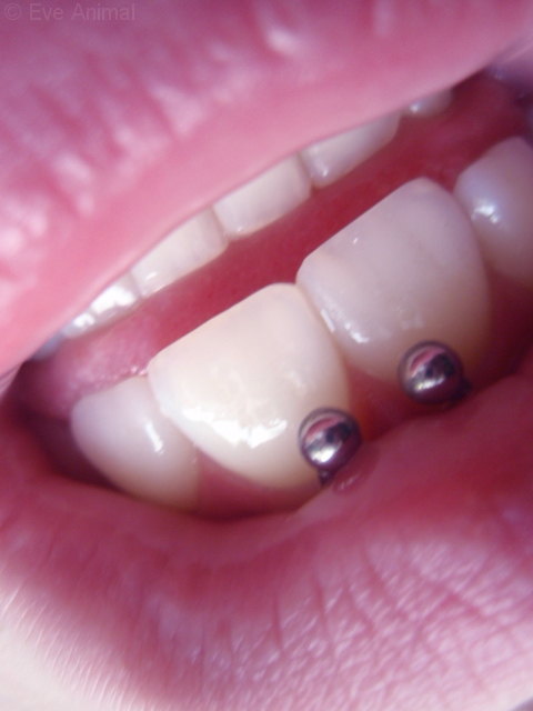 what is a smiley piercing. smiley piercing by EveAnimal