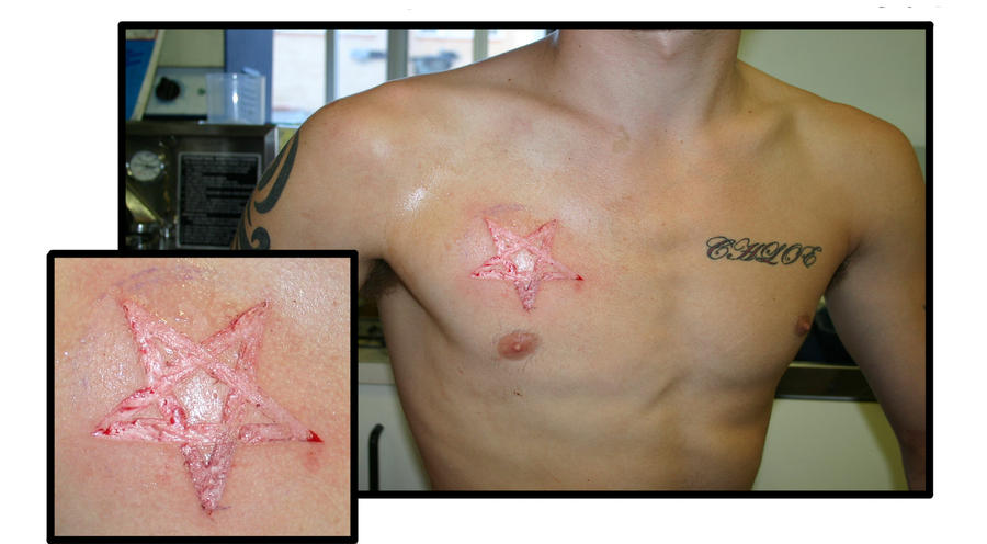 scarification tattoo. scarification tattoo by